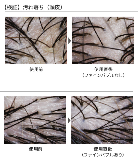 頭皮汚れのある部位にReFa FINE BUBBLE Uのストレートモードを使用して試験した結果