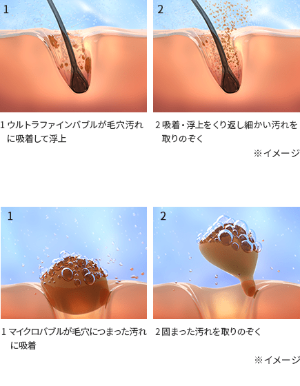 リファファインバブルUプラスの特徴